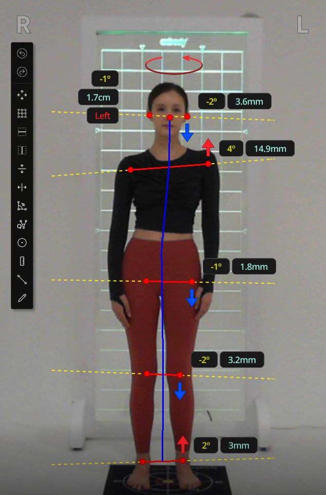 Posture Analysis